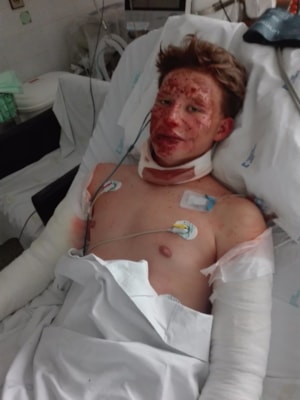 4-IMG_20170727_161743