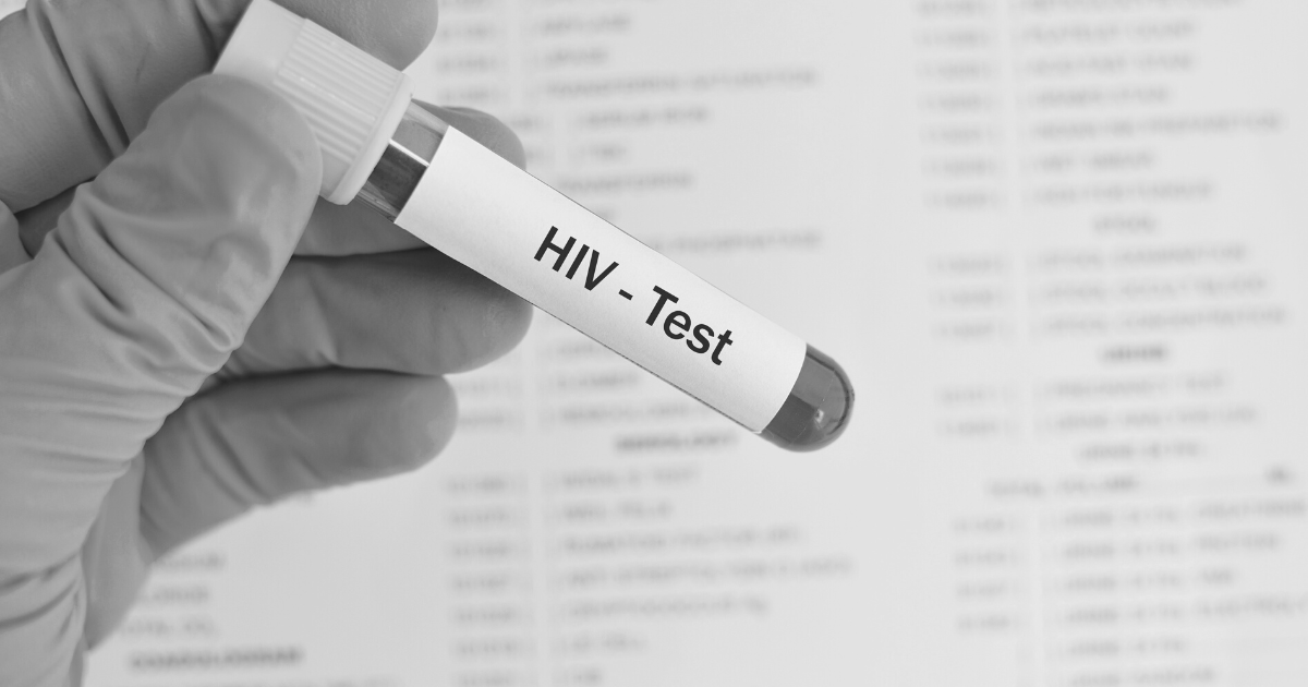 Nemocný banán pozná každý. HIV ale vidět není, testuj se včas